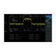 1001012